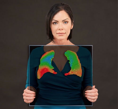 Veronica Landry poses with a recent diagnostic scan of damage in her lungs.